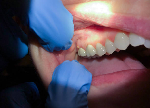 Best Tooth Infection Emergency Dentist  in Eau Claire, WI
